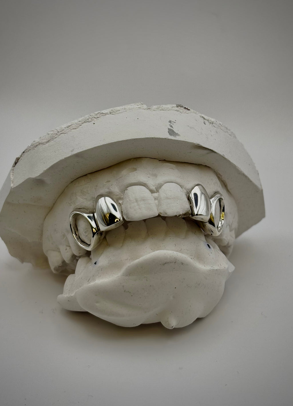 window canines + plain Laterals