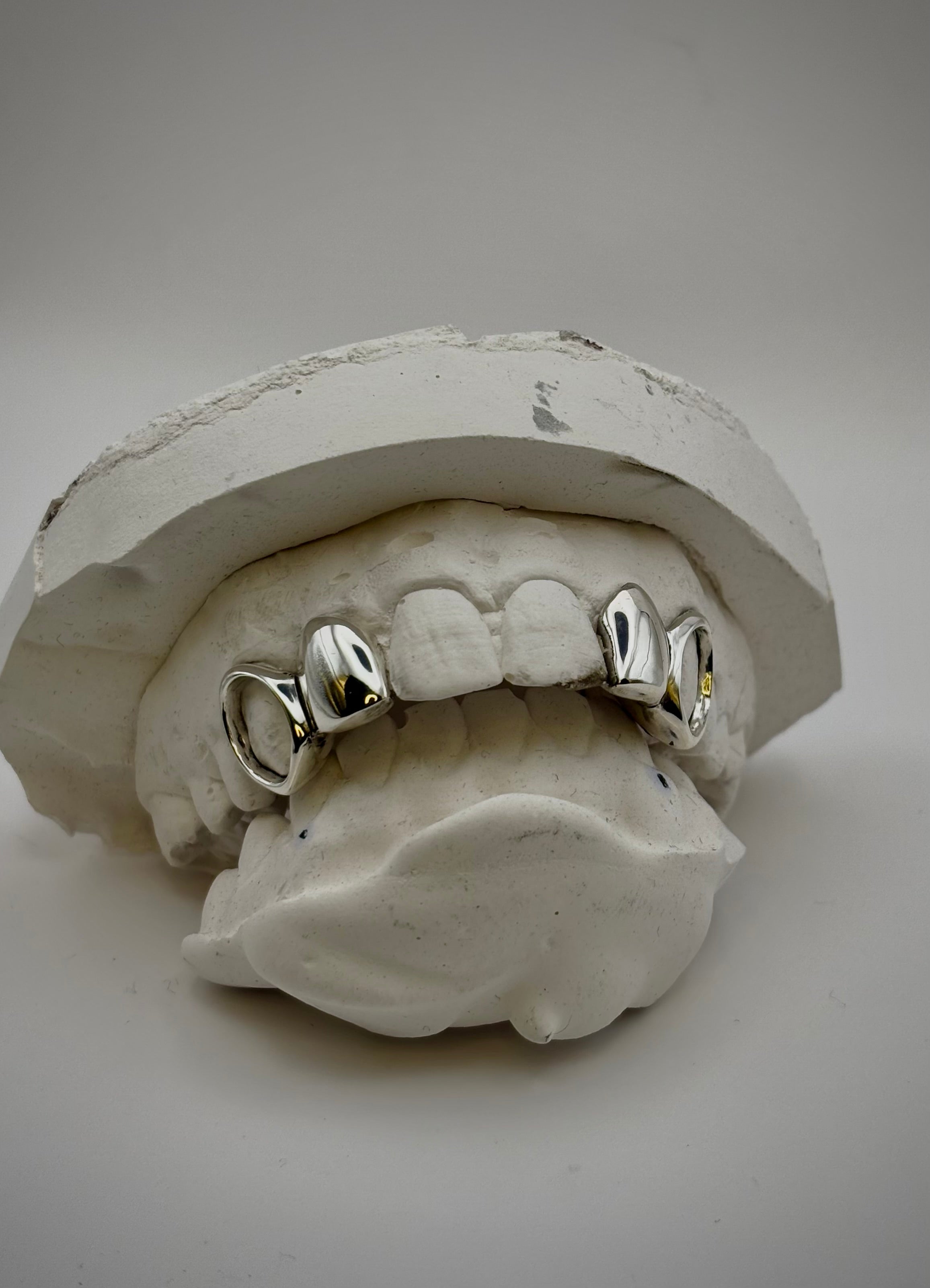 window canines + plain Laterals